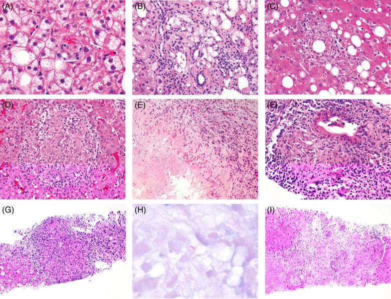 https://cdn.ncbi.nlm.nih.gov/pmc/blobs/9e9a/10948139/16edbf0db88b/hc9-8-e0392-g002.jpg
