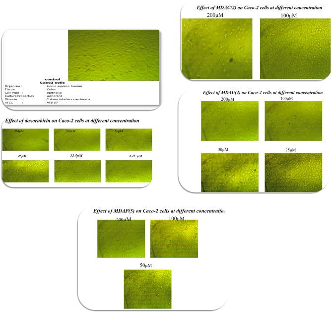 https://cdn.ncbi.nlm.nih.gov/pmc/blobs/9e9f/10477303/b8dd47b1381d/41598_2023_41528_Fig5_HTML.jpg