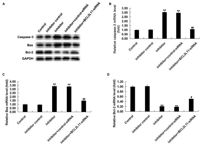 https://cdn.ncbi.nlm.nih.gov/pmc/blobs/9ea2/7086294/cb5e0953db33/etm-19-04-2467-g04.jpg