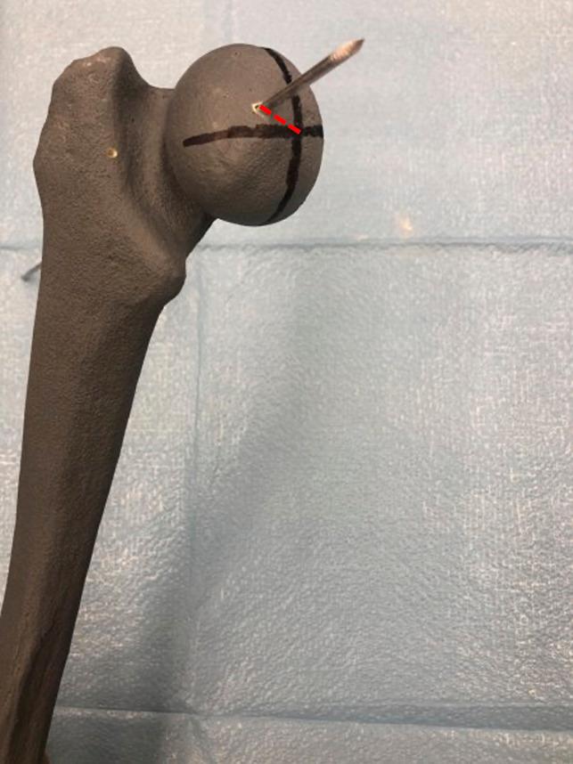 https://cdn.ncbi.nlm.nih.gov/pmc/blobs/9ea4/9042586/9d97c050c801/jagrr-6-e22.00028-g005.jpg