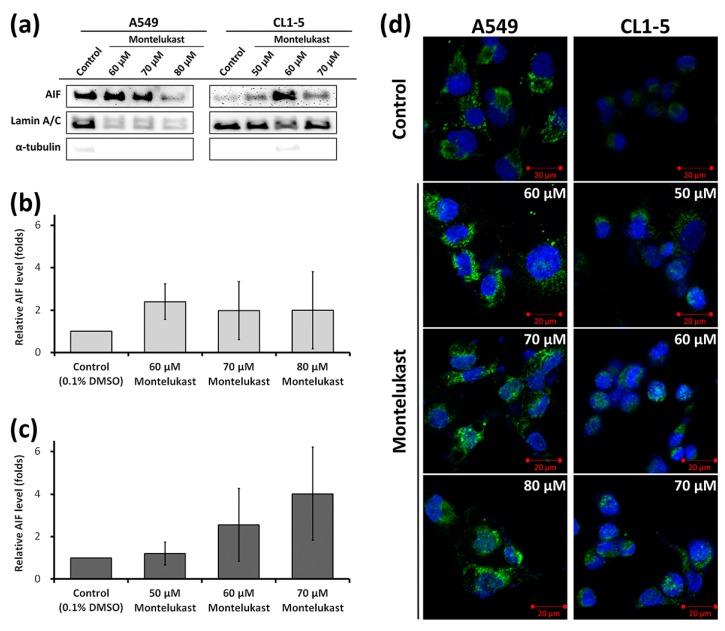 https://cdn.ncbi.nlm.nih.gov/pmc/blobs/9ea6/5535846/411b1af61852/ijms-18-01353-g004.jpg