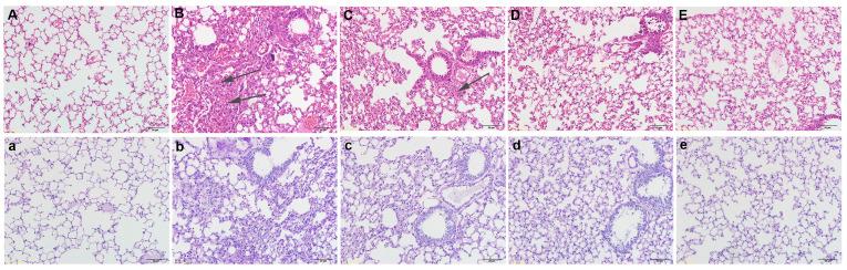 https://cdn.ncbi.nlm.nih.gov/pmc/blobs/9ea7/11893829/9a6806673f3e/fimmu-16-1549459-g001.jpg