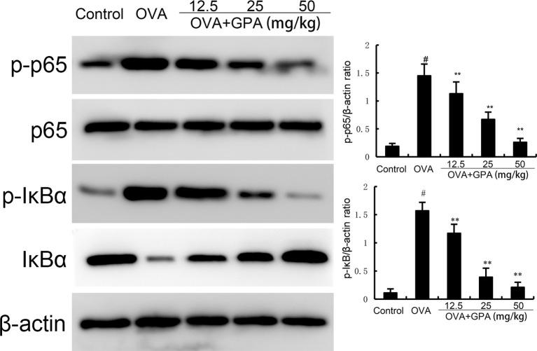 https://cdn.ncbi.nlm.nih.gov/pmc/blobs/9ea7/11893829/aa5448e8dfe6/fimmu-16-1549459-g005.jpg