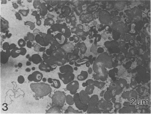 https://cdn.ncbi.nlm.nih.gov/pmc/blobs/9eac/267563/246f3bf86de8/jcm00066-0259-d.jpg