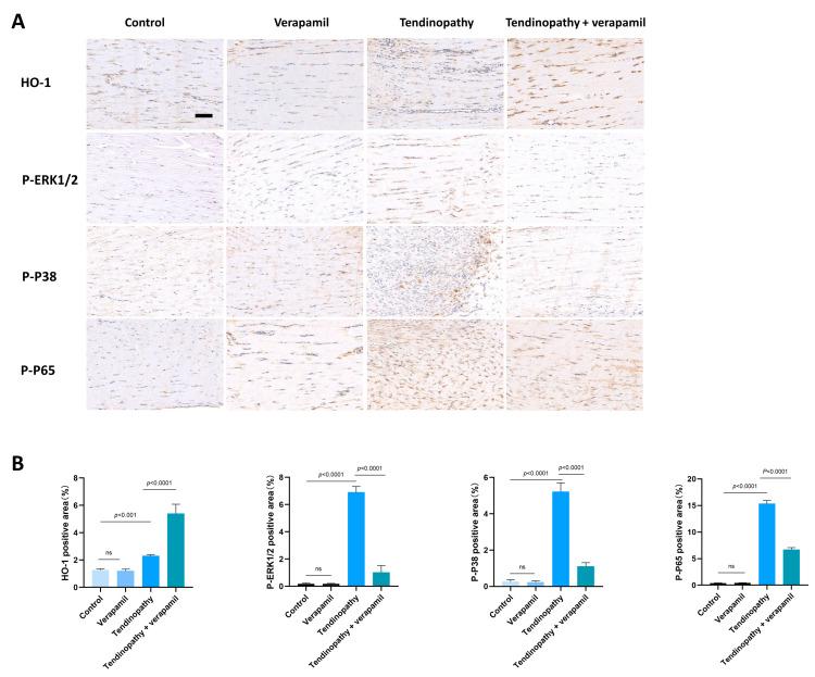 https://cdn.ncbi.nlm.nih.gov/pmc/blobs/9eb2/11048132/6261779855f2/biomedicines-12-00904-g011.jpg