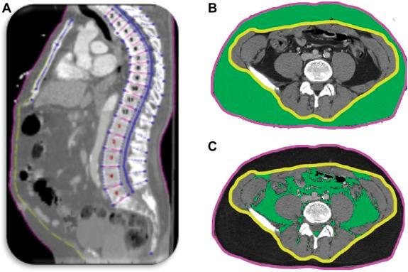 https://cdn.ncbi.nlm.nih.gov/pmc/blobs/9eb3/4450915/9f291840cbd0/ibd-21-1306-g001.jpg