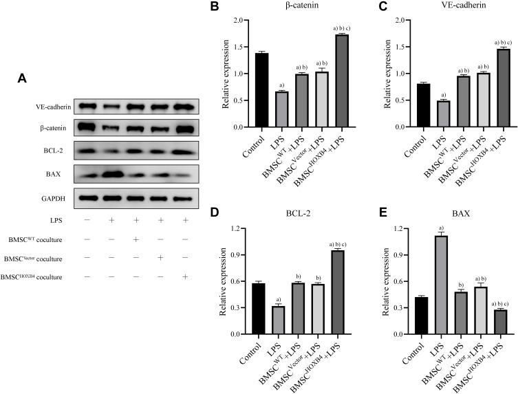 https://cdn.ncbi.nlm.nih.gov/pmc/blobs/9eb7/8326777/cdfb3dc4326f/JIR-14-3637-g0004.jpg