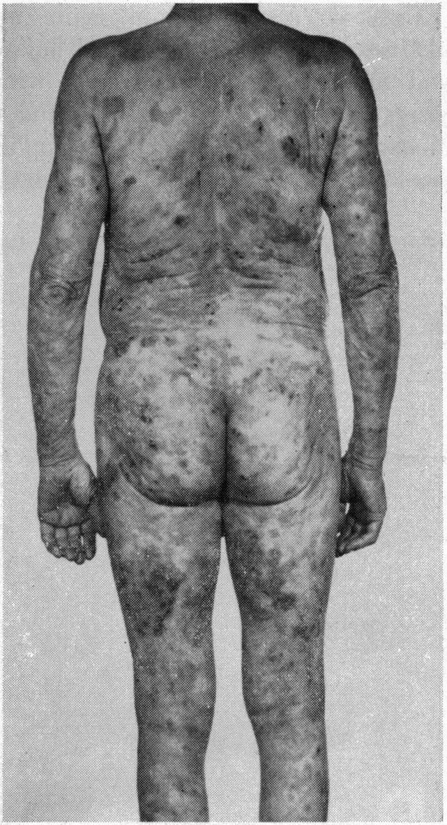 https://cdn.ncbi.nlm.nih.gov/pmc/blobs/9ebb/1574688/816fb10001fc/califmed00173-0075-c.jpg