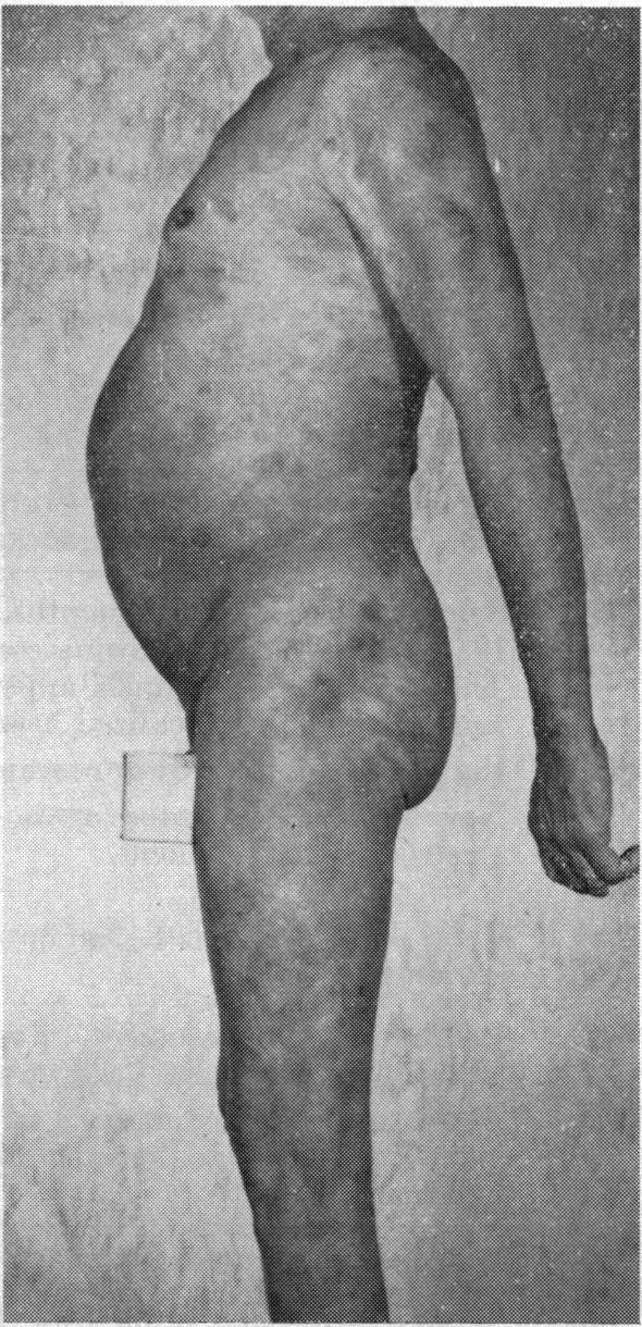 https://cdn.ncbi.nlm.nih.gov/pmc/blobs/9ebb/1574688/d9bf2716ef92/califmed00173-0075-e.jpg