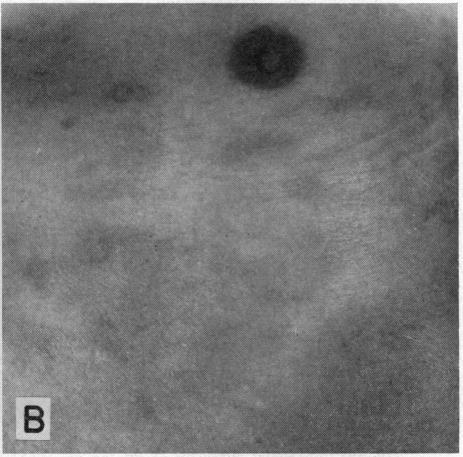 https://cdn.ncbi.nlm.nih.gov/pmc/blobs/9ebb/1574688/fd703c7c504b/califmed00173-0076-b.jpg