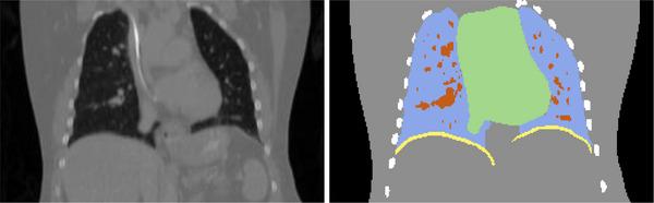 https://cdn.ncbi.nlm.nih.gov/pmc/blobs/9ec1/12258004/26eaca4798e4/MP-52-0-g004.jpg