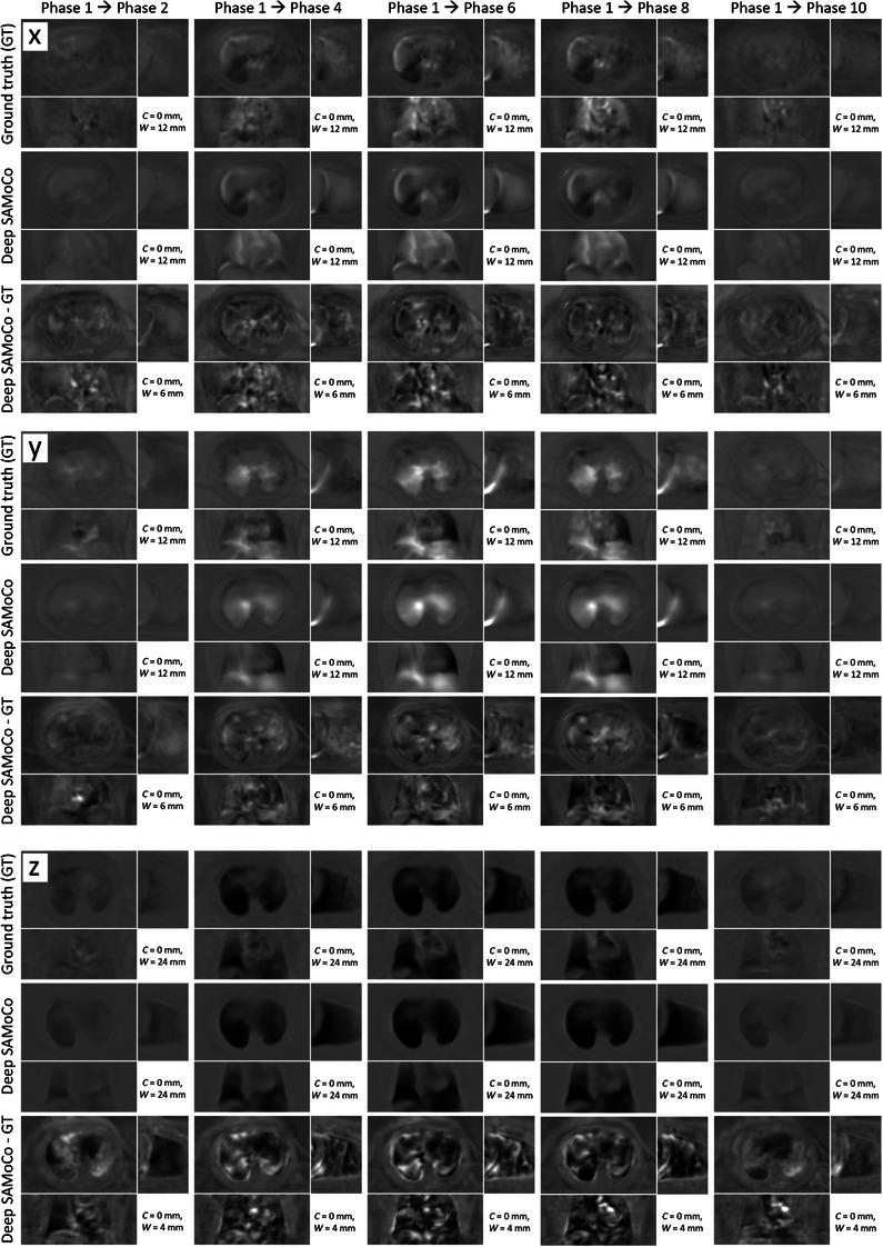 https://cdn.ncbi.nlm.nih.gov/pmc/blobs/9ec1/12258004/7f08425d17cf/MP-52-0-g006.jpg