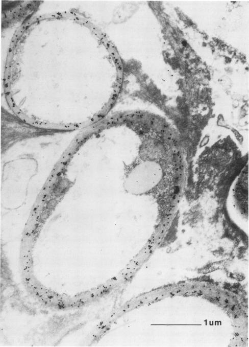 https://cdn.ncbi.nlm.nih.gov/pmc/blobs/9ec8/269727/412fe6e37de0/jcm00037-0215-a.jpg