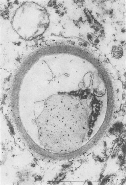 https://cdn.ncbi.nlm.nih.gov/pmc/blobs/9ec8/269727/baf8251bac5f/jcm00037-0216-a.jpg