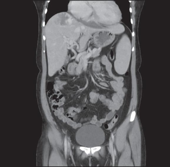 https://cdn.ncbi.nlm.nih.gov/pmc/blobs/9ec8/4382768/bab3a5b4540c/NAJMS-7-125-g004.jpg