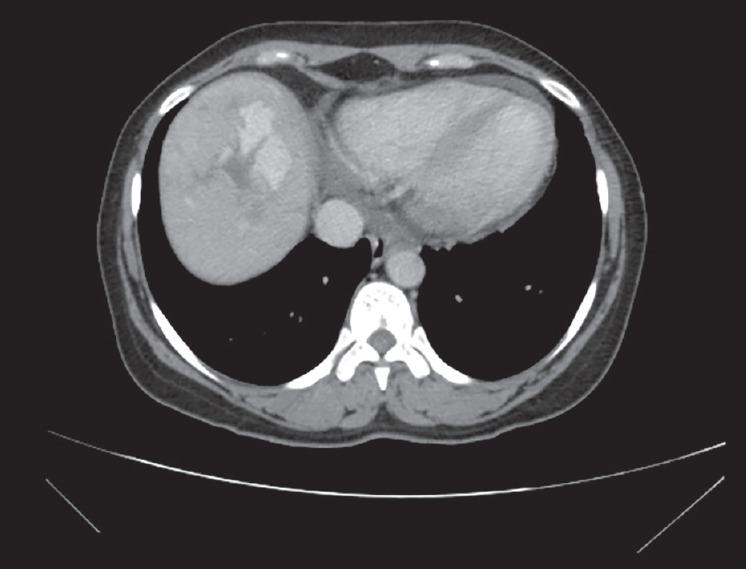 https://cdn.ncbi.nlm.nih.gov/pmc/blobs/9ec8/4382768/e6b146af1892/NAJMS-7-125-g003.jpg