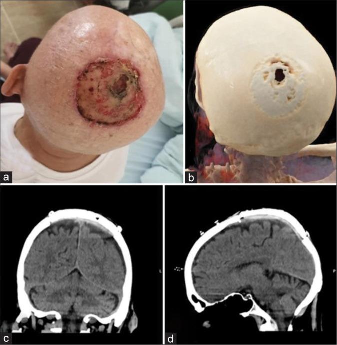 https://cdn.ncbi.nlm.nih.gov/pmc/blobs/9eca/10927182/925e586a6eb5/SNI-15-39-g002.jpg
