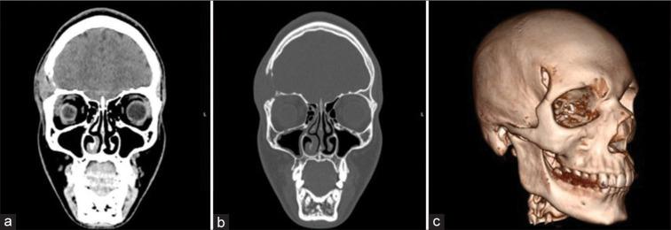 https://cdn.ncbi.nlm.nih.gov/pmc/blobs/9eca/10927182/ddf3e5d40041/SNI-15-39-g004.jpg