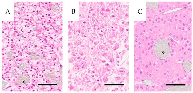 https://cdn.ncbi.nlm.nih.gov/pmc/blobs/9ecb/11119251/49f9b5f5de2d/cancers-16-01939-g002.jpg