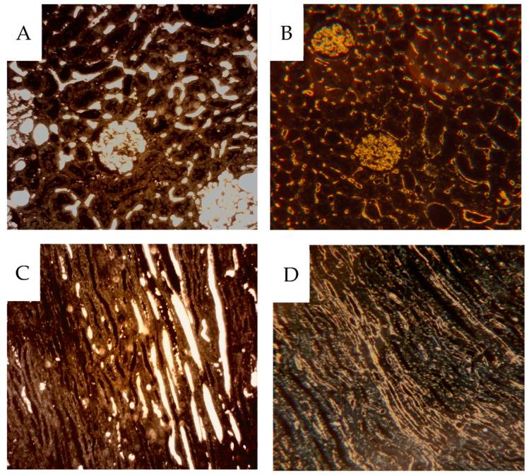 https://cdn.ncbi.nlm.nih.gov/pmc/blobs/9ecb/11119251/e4821a5ad5d1/cancers-16-01939-g009.jpg