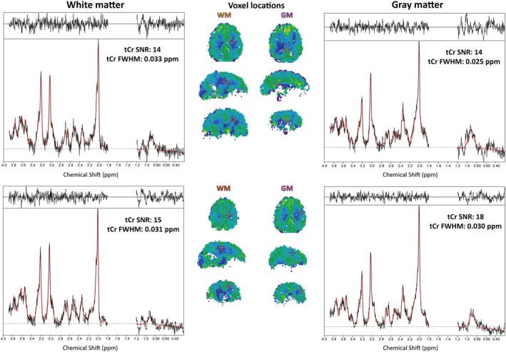 https://cdn.ncbi.nlm.nih.gov/pmc/blobs/9ecb/11475238/64dc2191224d/NBM-34-e4596-g001.jpg