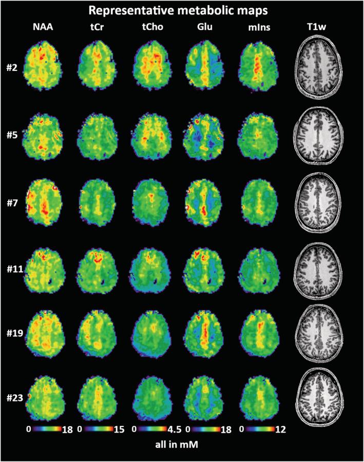 https://cdn.ncbi.nlm.nih.gov/pmc/blobs/9ecb/11475238/6588aec1b75e/NBM-34-e4596-g003.jpg