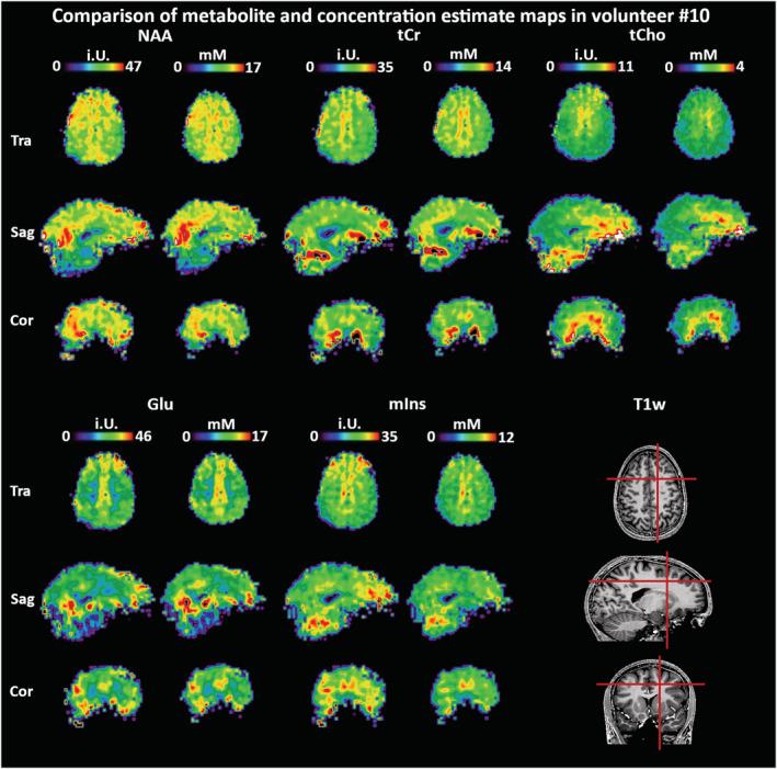 https://cdn.ncbi.nlm.nih.gov/pmc/blobs/9ecb/11475238/971c59d051e2/NBM-34-e4596-g004.jpg