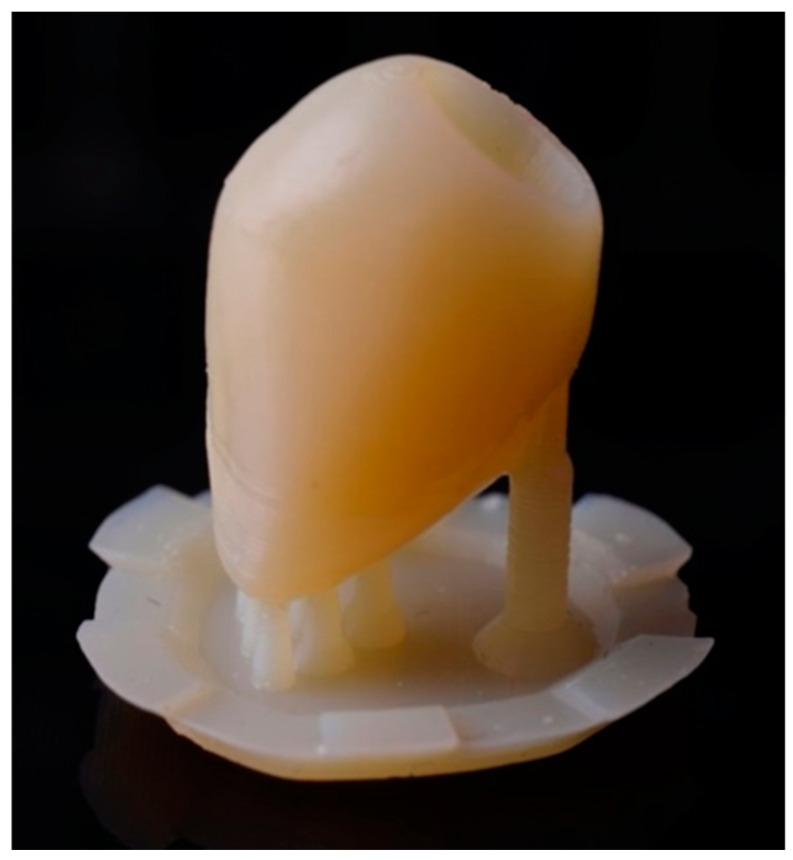 https://cdn.ncbi.nlm.nih.gov/pmc/blobs/9ecc/11275855/89a45a39b622/dentistry-12-00226-g005.jpg
