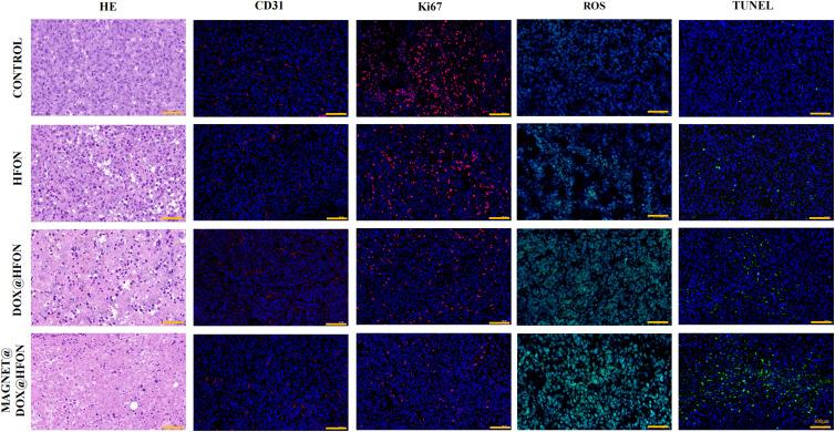 https://cdn.ncbi.nlm.nih.gov/pmc/blobs/9ecf/9904310/2d5e75cbd457/BCTT-15-101-g0008.jpg