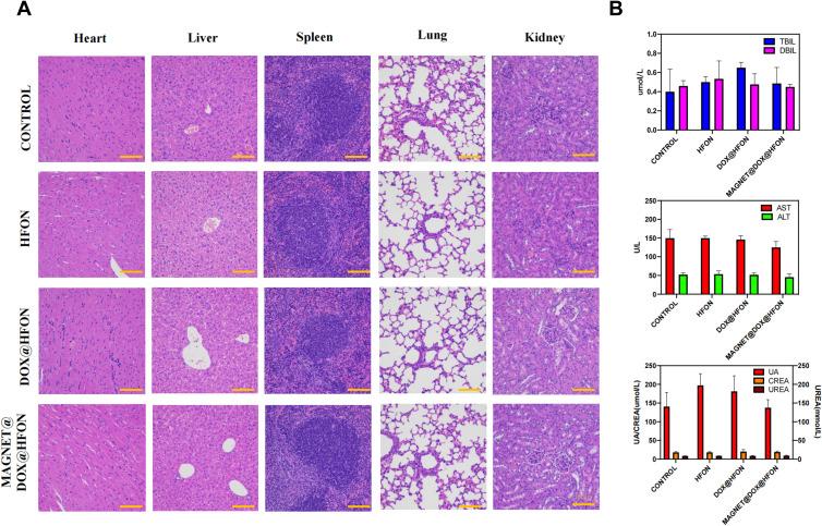 https://cdn.ncbi.nlm.nih.gov/pmc/blobs/9ecf/9904310/d6fc82422d4f/BCTT-15-101-g0009.jpg