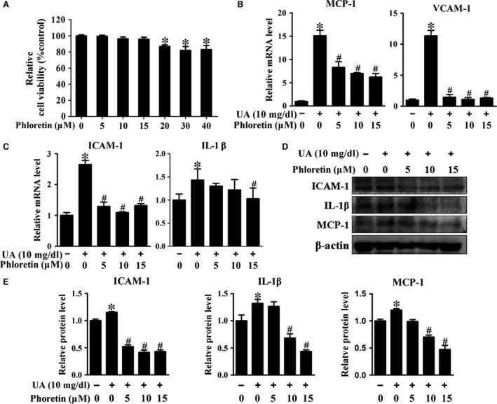https://cdn.ncbi.nlm.nih.gov/pmc/blobs/9ed0/5618667/2a1826f59730/JCMM-21-2553-g003.jpg