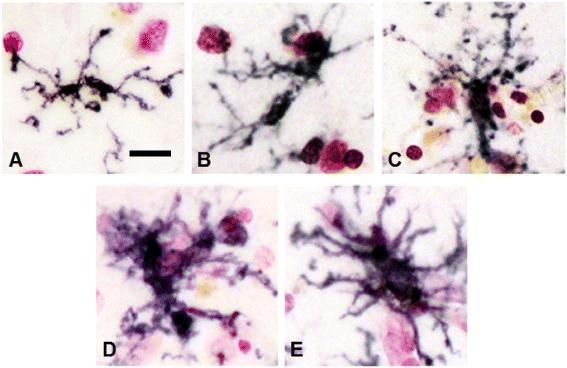https://cdn.ncbi.nlm.nih.gov/pmc/blobs/9ed2/4543480/baee45acbd77/13195_2015_139_Fig1_HTML.jpg