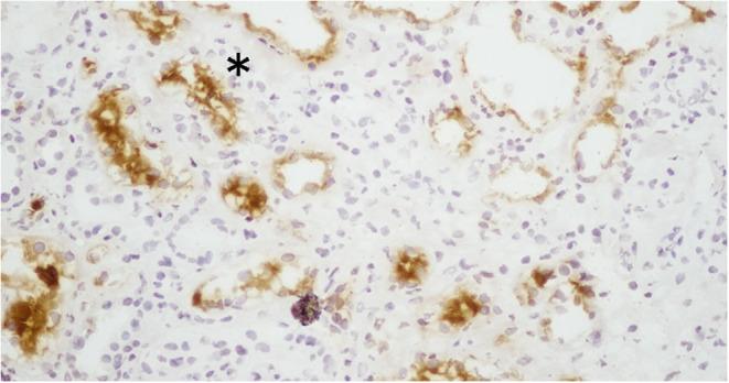 https://cdn.ncbi.nlm.nih.gov/pmc/blobs/9ed4/7677583/0941d16c89ec/fmed-07-591724-g0002.jpg