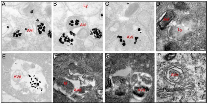 https://cdn.ncbi.nlm.nih.gov/pmc/blobs/9ed6/12191930/c140ec8fa6e2/cimb-47-00460-g006.jpg