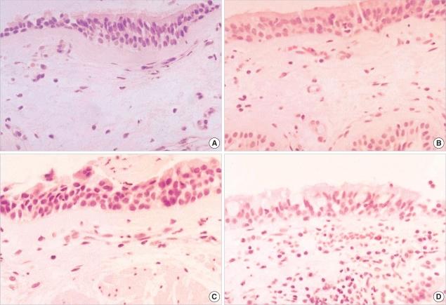 https://cdn.ncbi.nlm.nih.gov/pmc/blobs/9ed9/2526529/c25cca610883/jkms-23-390-g004.jpg