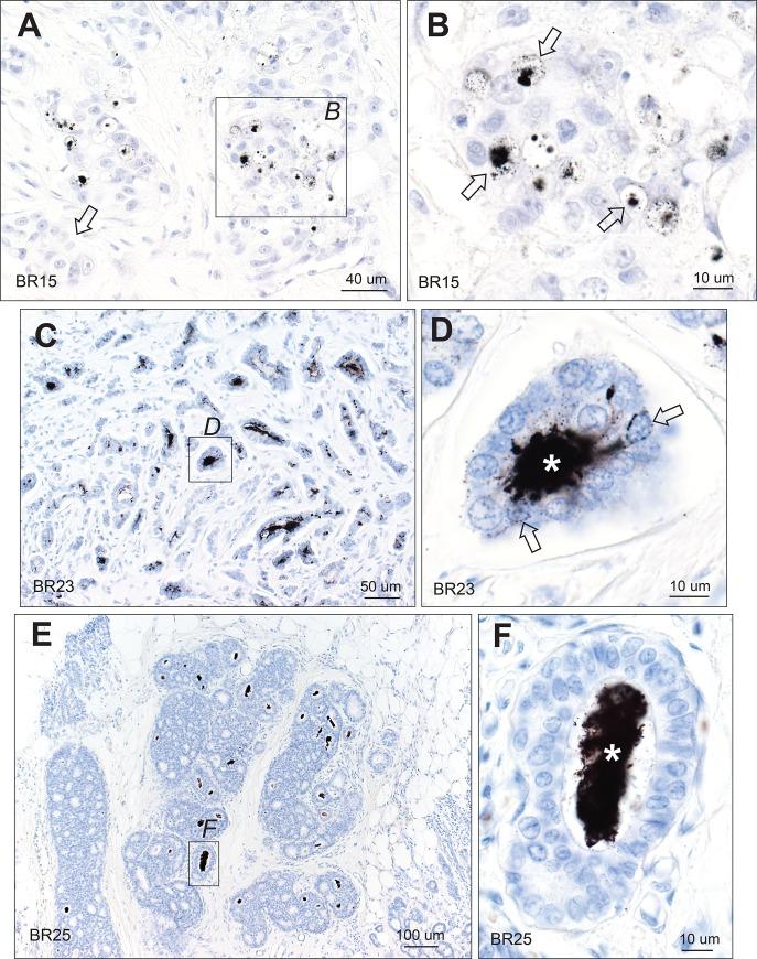 https://cdn.ncbi.nlm.nih.gov/pmc/blobs/9edf/6993973/0c4a18c3b96d/pone.0228226.g005.jpg