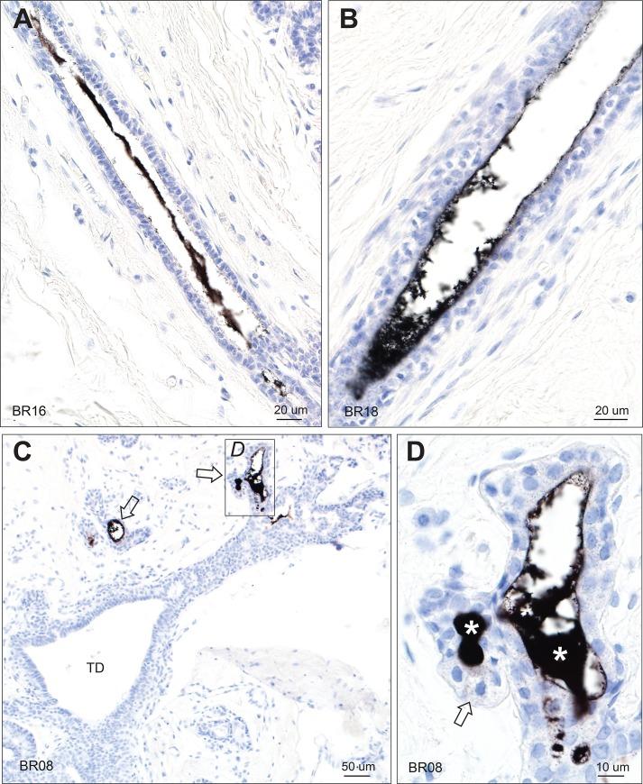 https://cdn.ncbi.nlm.nih.gov/pmc/blobs/9edf/6993973/a3888e350bec/pone.0228226.g004.jpg