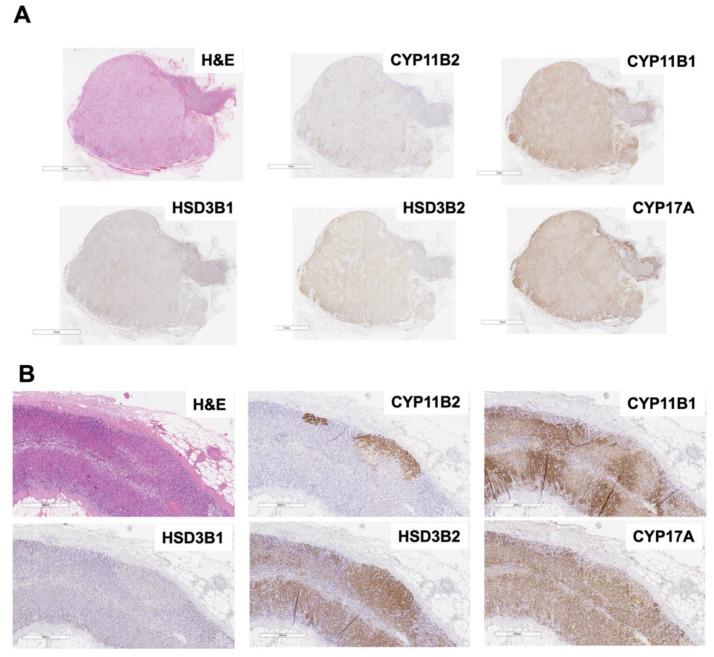 https://cdn.ncbi.nlm.nih.gov/pmc/blobs/9ee6/8002562/b1fa901d9b58/biomedicines-09-00310-g002.jpg