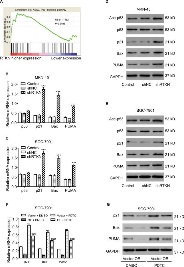 https://cdn.ncbi.nlm.nih.gov/pmc/blobs/9ee9/6354689/101f3cfa52c7/cmar-11-1069Fig4.jpg