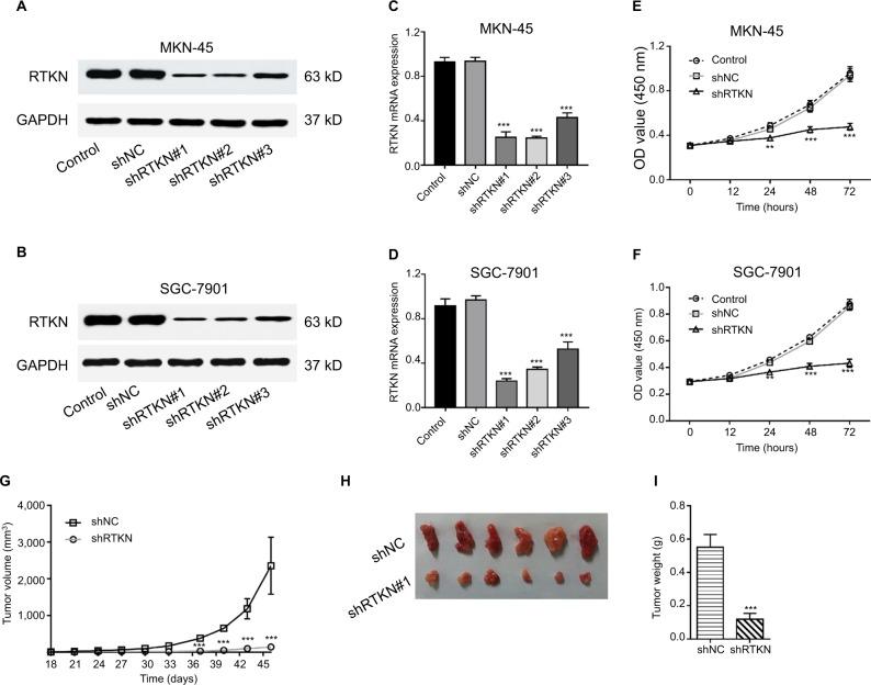 https://cdn.ncbi.nlm.nih.gov/pmc/blobs/9ee9/6354689/67e03e220083/cmar-11-1069Fig2.jpg