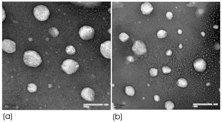 https://cdn.ncbi.nlm.nih.gov/pmc/blobs/9eee/12030045/65e07b84c59d/pharmaceutics-17-00478-g003.jpg