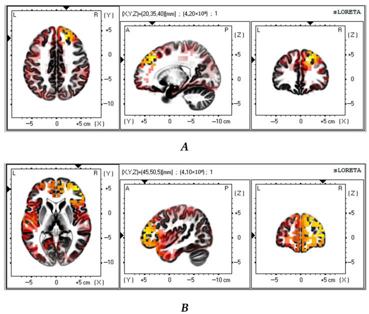 https://cdn.ncbi.nlm.nih.gov/pmc/blobs/9ef4/12292947/628fd8048a02/biomedicines-13-01755-g004.jpg