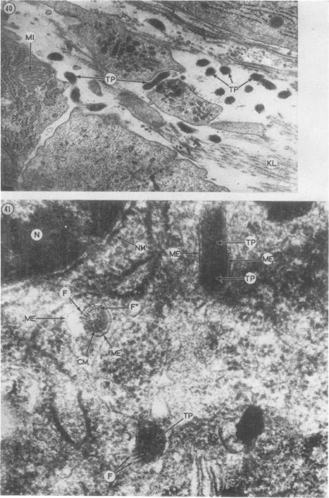 https://cdn.ncbi.nlm.nih.gov/pmc/blobs/9ef8/1048099/4f8852d63a32/brjvendis00089-0024-a.jpg