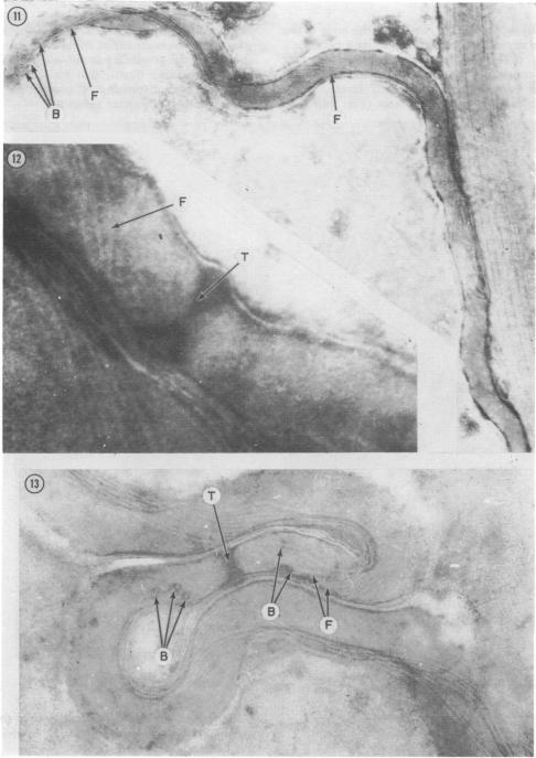 https://cdn.ncbi.nlm.nih.gov/pmc/blobs/9ef8/1048099/5a9cad847ef3/brjvendis00089-0007-a.jpg