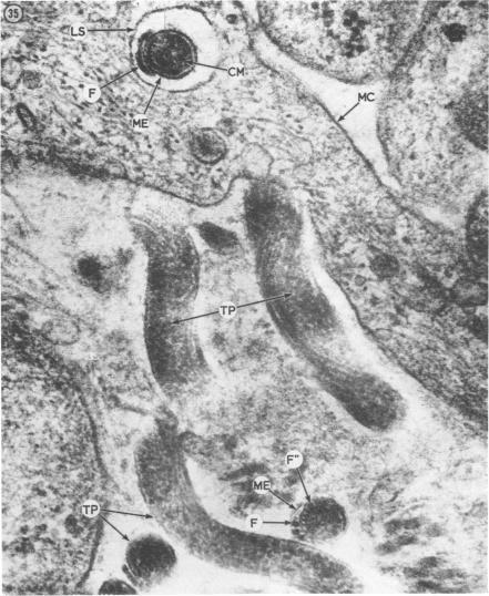 https://cdn.ncbi.nlm.nih.gov/pmc/blobs/9ef8/1048099/8a4a6baacee2/brjvendis00089-0019-a.jpg