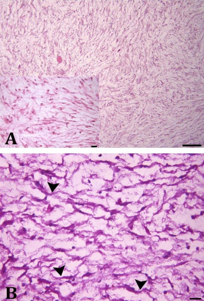 https://cdn.ncbi.nlm.nih.gov/pmc/blobs/9efa/8094150/d5a1fc6207cd/vrf-12-129-g002.jpg