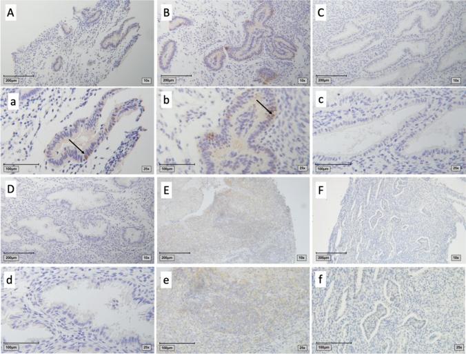 https://cdn.ncbi.nlm.nih.gov/pmc/blobs/9f04/10192152/4d871539491f/404_2023_7033_Fig1_HTML.jpg
