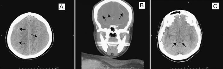 https://cdn.ncbi.nlm.nih.gov/pmc/blobs/9f06/3298218/24a2eecbb068/wjem-13-01-42w-f01.jpg