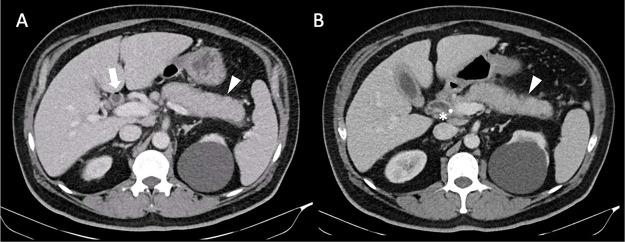 https://cdn.ncbi.nlm.nih.gov/pmc/blobs/9f09/12365821/7004dbdaa078/gr1.jpg