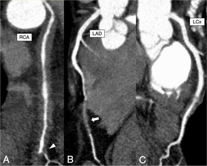 https://cdn.ncbi.nlm.nih.gov/pmc/blobs/9f09/12365821/ba1b5a5dc355/gr3.jpg